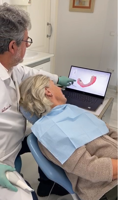Scanner intrabucal de Clínica Dental Moraira