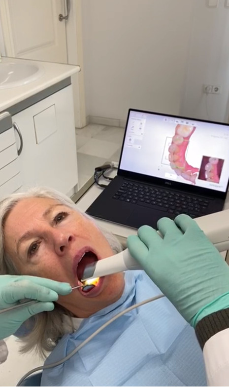 Escáner dental intrabucal de Clínica Dental Moraira