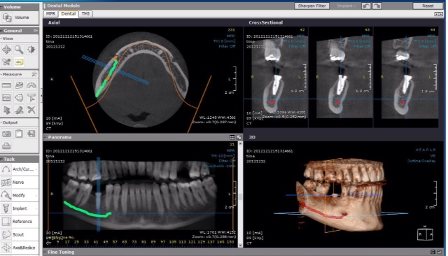 Diagnóstico digital Clínica Dental Moraira