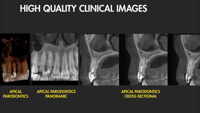 Imagen diagnóstico dental endodoncia en la Clínica Dental Moraira