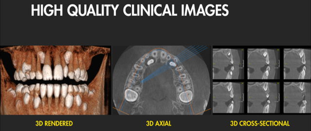 Imagen diagnóstico dental ortodoncia en la Clínica Dental Moraira