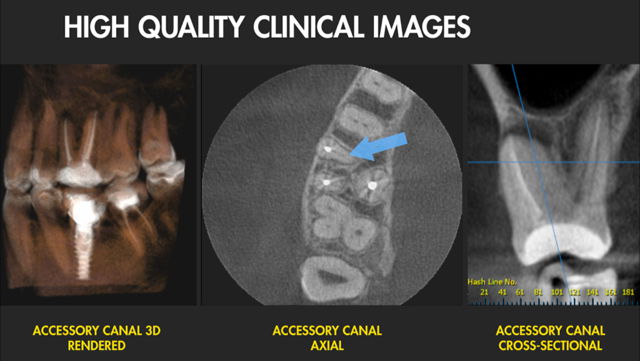 Imagen diagnóstico por la imagen en la Clínica Dental Moraira