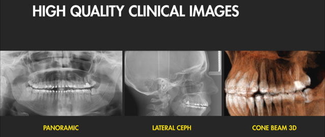 Imagen diagnóstico por la imagen en ortodoncia en la Clínica Dental Moraira